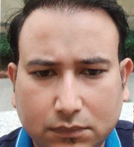amit-img